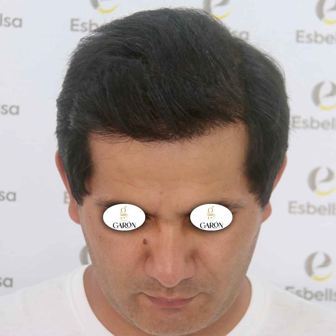 2 después (1) (1)