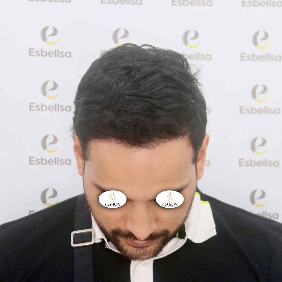 4 después_ (1)